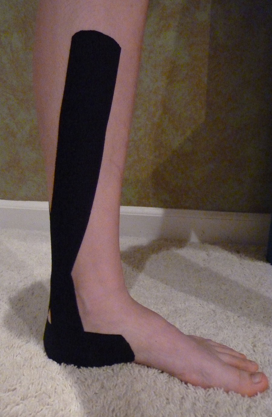 Kinesio Taping Personal Story – HEEL PAIN -